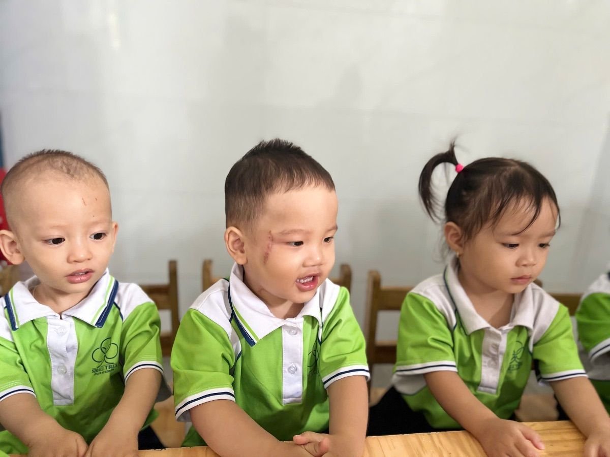 Ảnh hoạt động